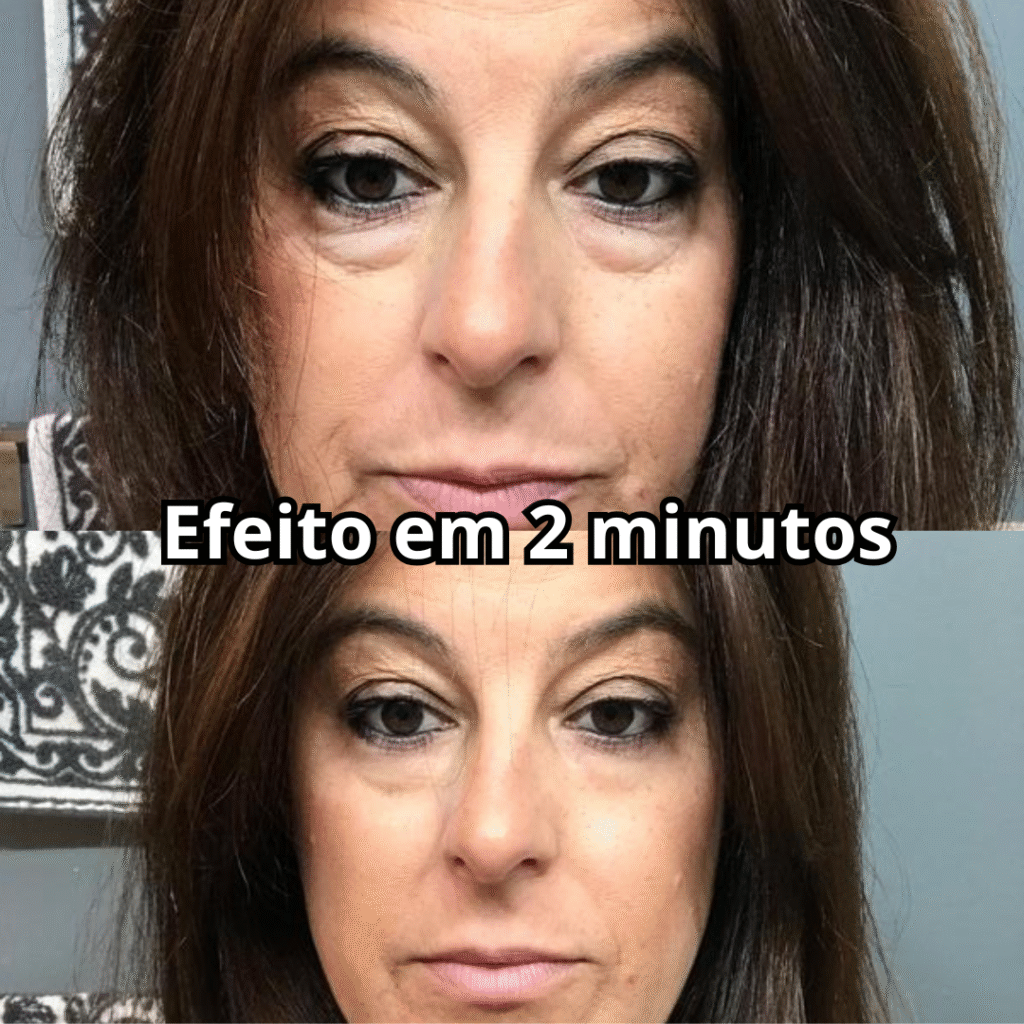 Foto antes e depois compartilhada por cliente do Remove Japan