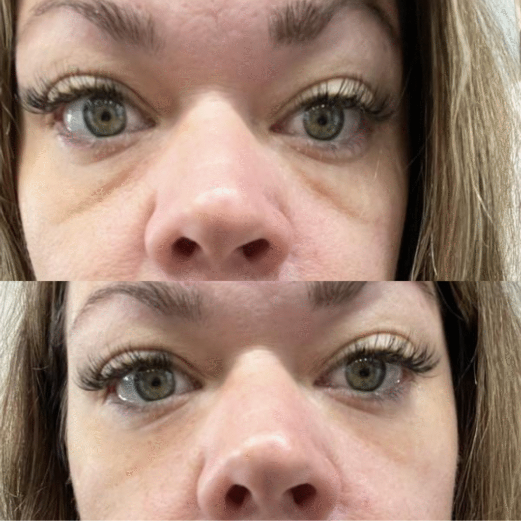 Foto antes e depois compartilhada por cliente do Remove Japan