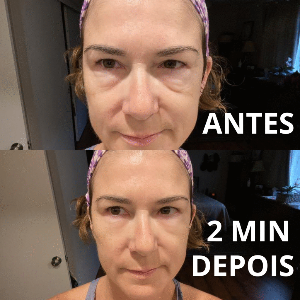 Foto antes e depois compartilhada por cliente do Remove Japan